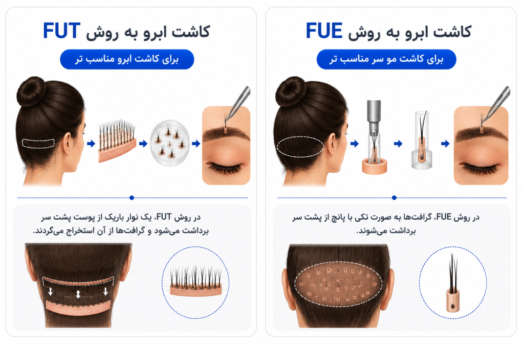 انواع روش های کاشت ابرو