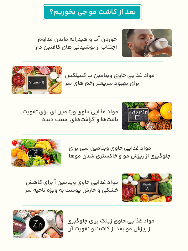 بعد از کاشت مو چی بخوریم ؟