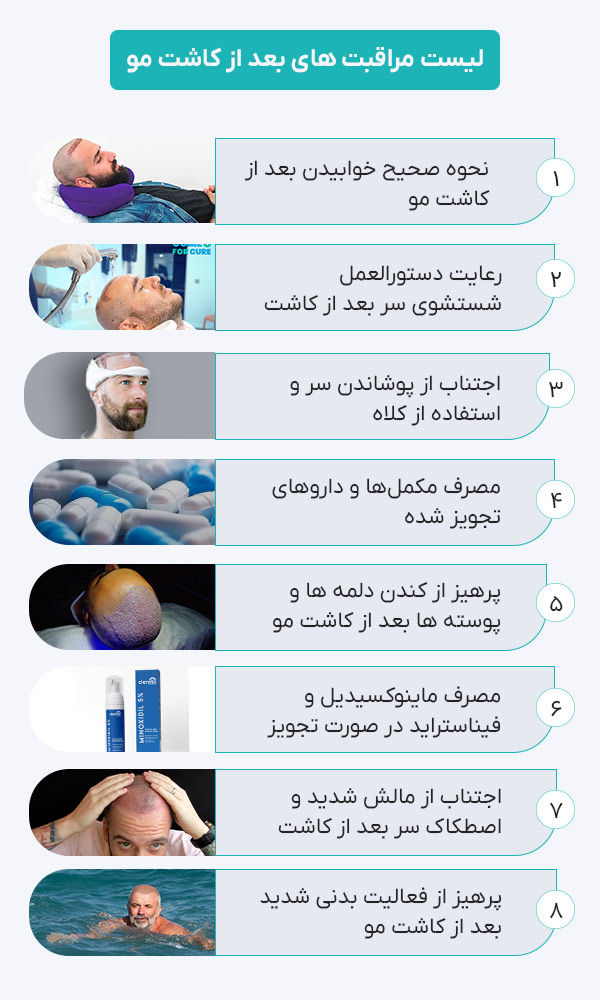 مهم ترین مراقبت های بعد از کاشت مو
