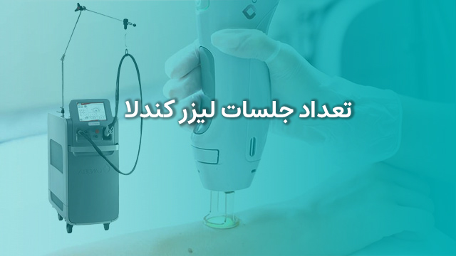 تعداد جلسات لیزر کندلا