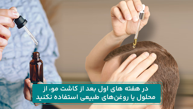 پیشگیری از ریزش مو بعد از کاشت 5 در هفته های اول بعد از کاشت مو، از محلول یا روغنهای طبیعی استفاده نکنید.