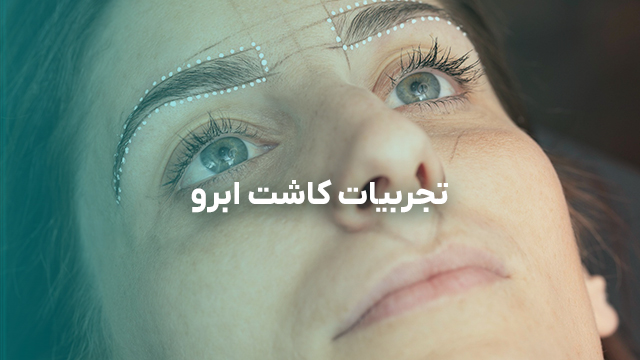 تجربیات کاشت ابرو