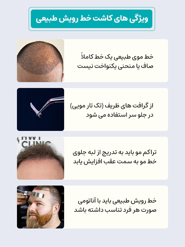 ویژگی های کاشت و طراحی خط رویش مو طبیعی
