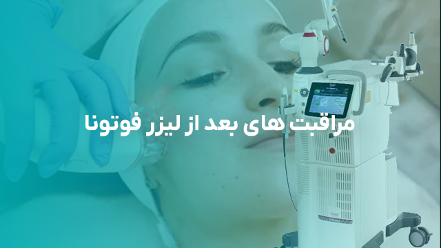 مراقبت های بعد از لیزر فوتونا