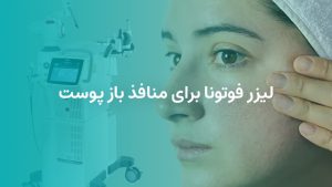 وبلاگ 22 لیزر فوتونا برای منافذ باز پوست
