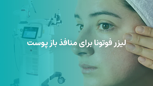 لیزر فوتونا برای منافذ باز پوست
