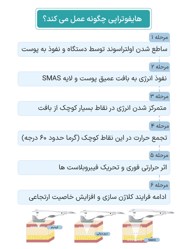 لیزر فوتونا چگونه منجر به جوانسازی پوست می شود؟