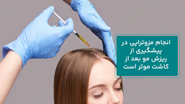 پیشگیری از ریزش مو بعد از کاشت 4 انجام مزوتراپی در پیشگیری از ریزش مو بعد از کاشت موثر است.