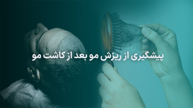 پیشگیری از ریزش مو بعد از کاشت