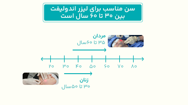 سن مناسب برای اندولیفت در مردان و زنان