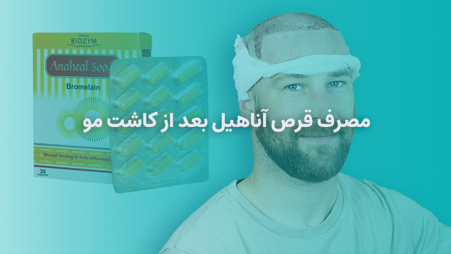 قرص آناهیل بعد از کاشت مو