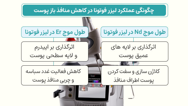 لیزر فوتونا برای منافذ باز پوست 1 تاثیر لیزر فوتونا در کاهش منافذ پوست