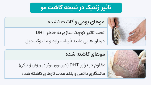 تاثیر ژنتیک در کاشت مو 2 تاثیر ژنتیک در نتیجه کاشت مو