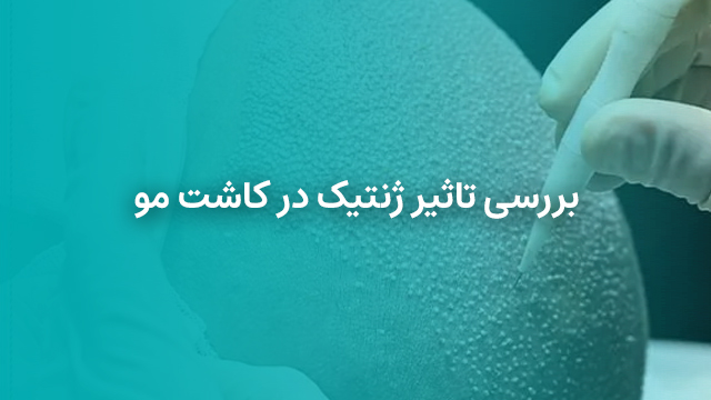 تاثیر ژنتیک در کاشت مو