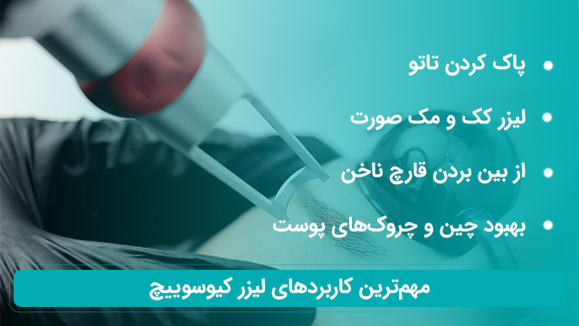 لیزر کیوسوییچ در شیراز 2 کاربردهای اصلی لیزر کیوسوییچ