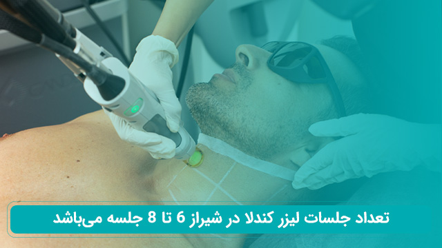 تعداد جلسات و مدت زمان هر جلسه لیزر کندلا