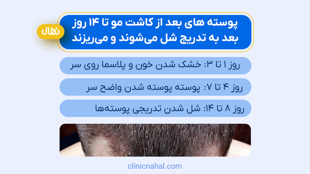 پوسته های بعد از کاشت مو تا 14 روز بعد به تدریج شل می‌شوند و می‌ریزند.