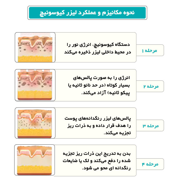 لیزر کیوسوئیچ چیست و چگونه کار می کند؟