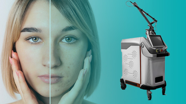 لیزر کیوسوییچ در شیراز 1 روش کار لیزر کیوسوییچ به چه صورت است؟