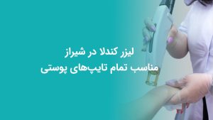 وبلاگ 22 لیزر کندلا در شیراز