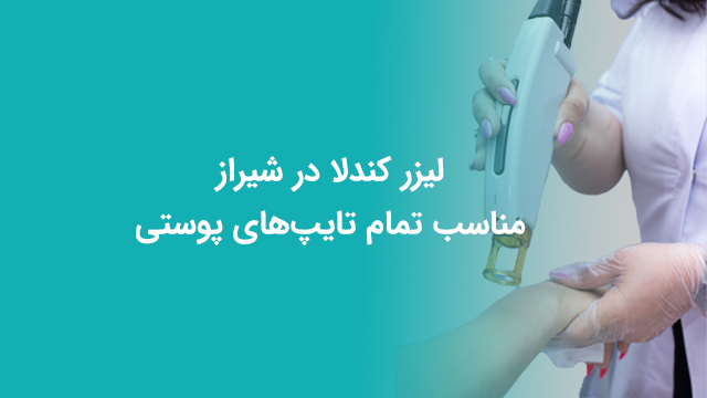 لیزر کندلا در شیراز