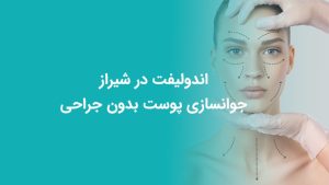 وبلاگ 20 اندولیفت در شیراز