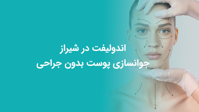 اندولیفت در شیراز
