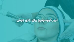 لیزر کیوسوئیچ برای جای جوش