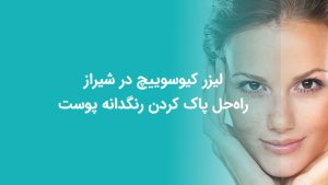 وبلاگ 23 لیزر کیوسوییچ در شیراز