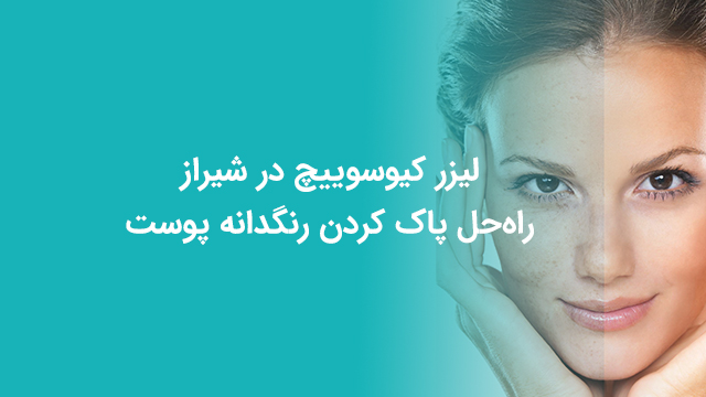 لیزر کیوسوییچ در شیراز