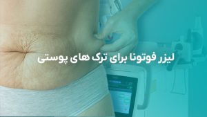 لیزر فوتونا برای ترک های پوستی