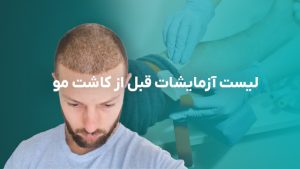 آزمایشات قبل از کاشت مو