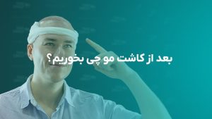 بعد از کاشت مو چی بخوریم ؟